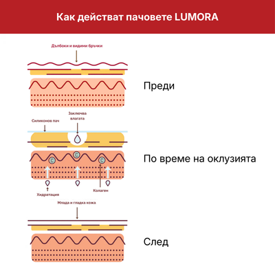 Lumora Силиконови Пачове